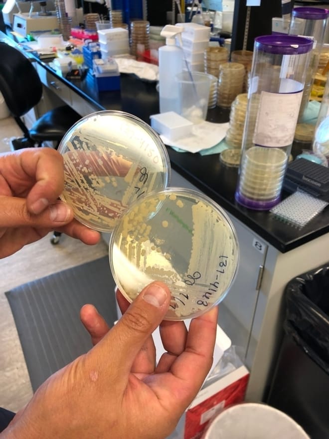 A pair of hands holding two petri dishes